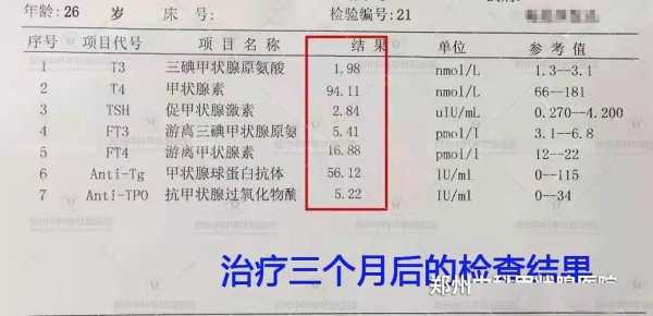 甲減可以吃生姜嗎（甲減可以喝姜粉嗎）-圖3