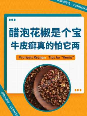 生姜花椒白醋治療銀屑?。ù字蠡ń匪苤毋y屑病嗎）-圖2