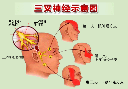 生姜治三叉神經(jīng)-圖2