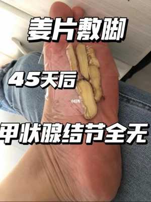 生姜與甲狀腺