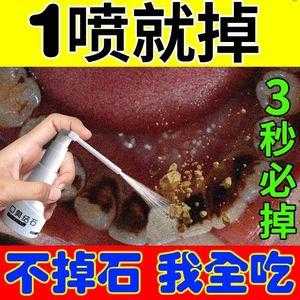 白醋和生姜怎么去除牙結(jié)石-圖2