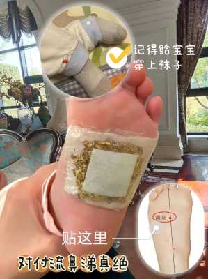 嬰兒發(fā)燒腳底貼生姜可以嗎